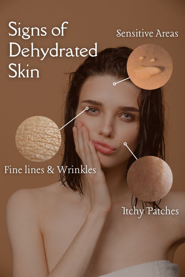 How to Tackle Dry Skin